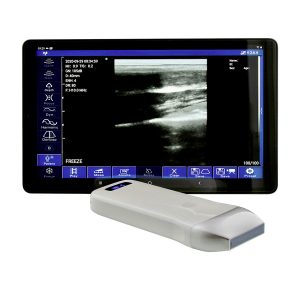 Wireless Ultrasound Single Linear Head B&W Scanner